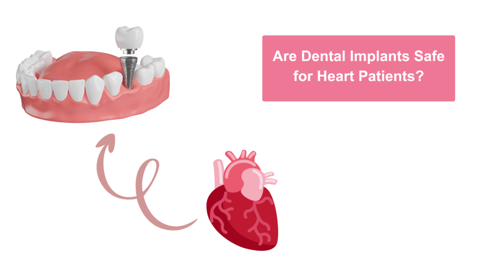 Are Dental Implants Safe for Heart Patients