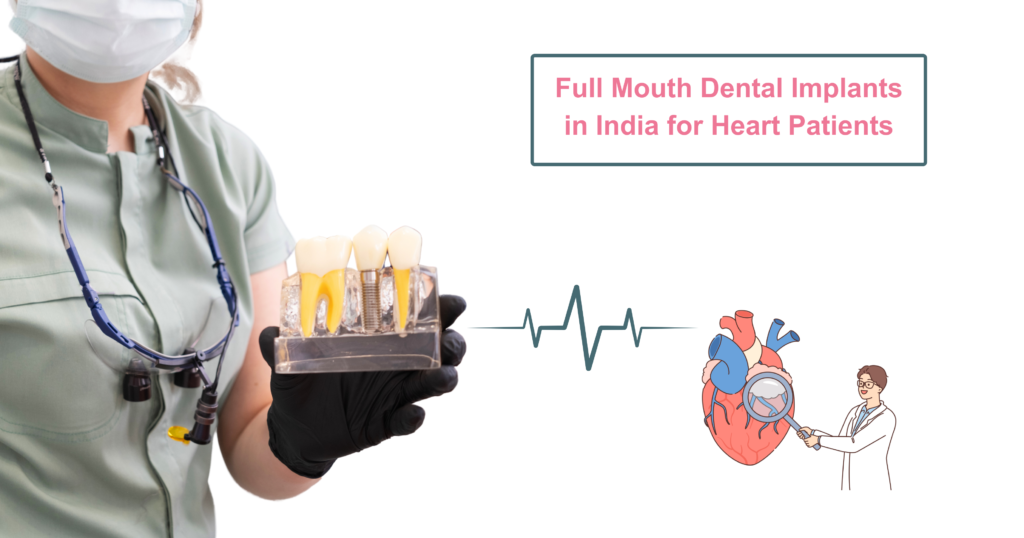 Full Mouth Dental Implants in India for Heart Patients