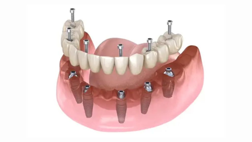 homepage slider for clothing brand website sale (blog banner) (16)