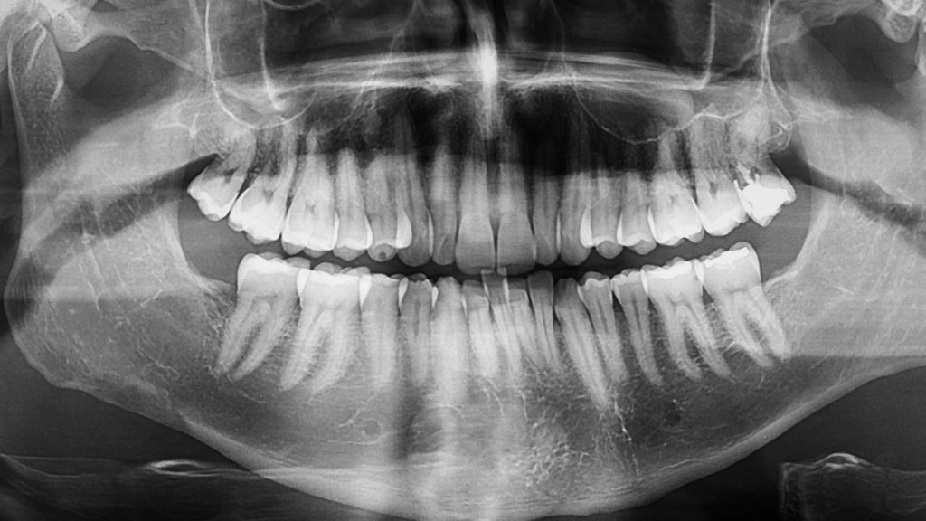 homepage slider for clothing brand website sale (blog banner) (20)